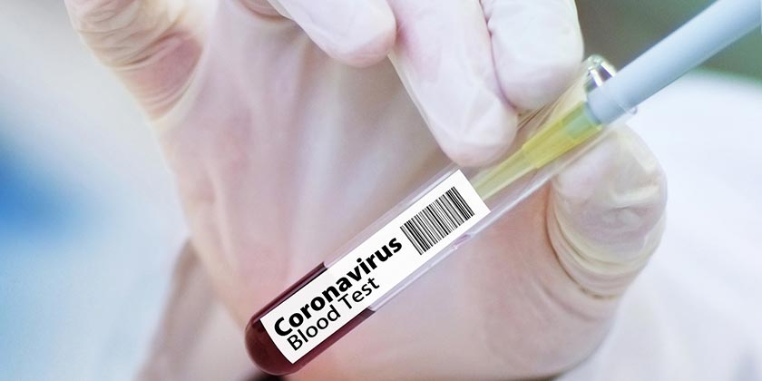 vaccine1-Corona_Pixabay