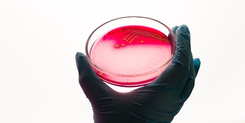 Вирус дал ученым средство от опасной бактерии