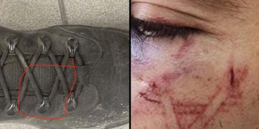 Министерство юстиции Израиля восстановило удаленное видео, на котором запечатлено насилие в отношении палестинца