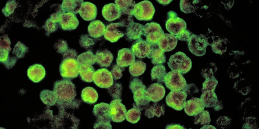 «Амеба, поедающая мозг»: все, что нужно знать о смертельном патогене, обнаруженном в Израиле