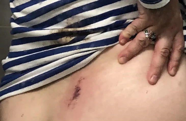 Семья кабанов ранила и ограбила репатриантку из Украины